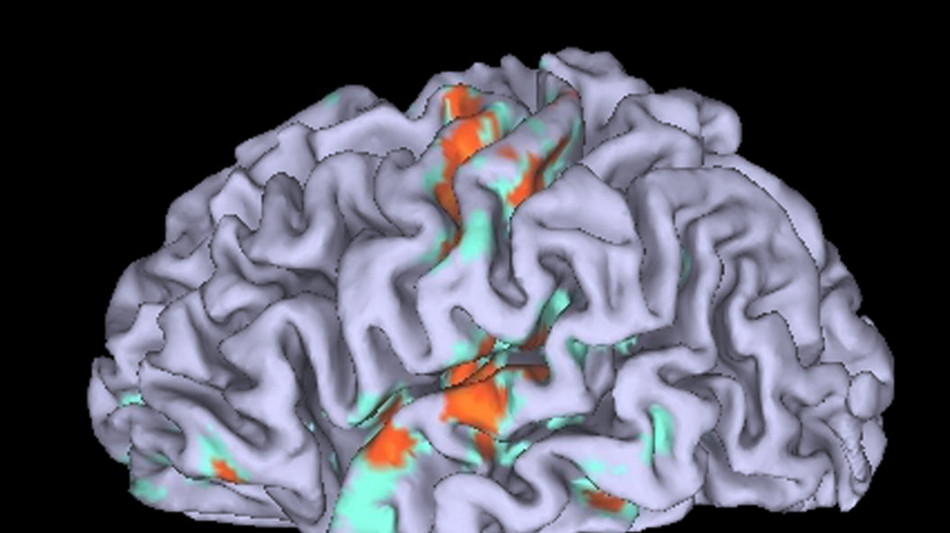 Il cervello non &egrave; uno solo, in realt&agrave; sono due organi distinti