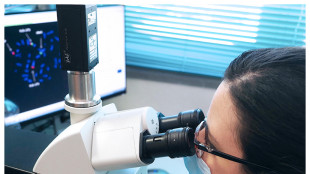 Strumento IA sonda genoma in cerca di punti chiave per la salute