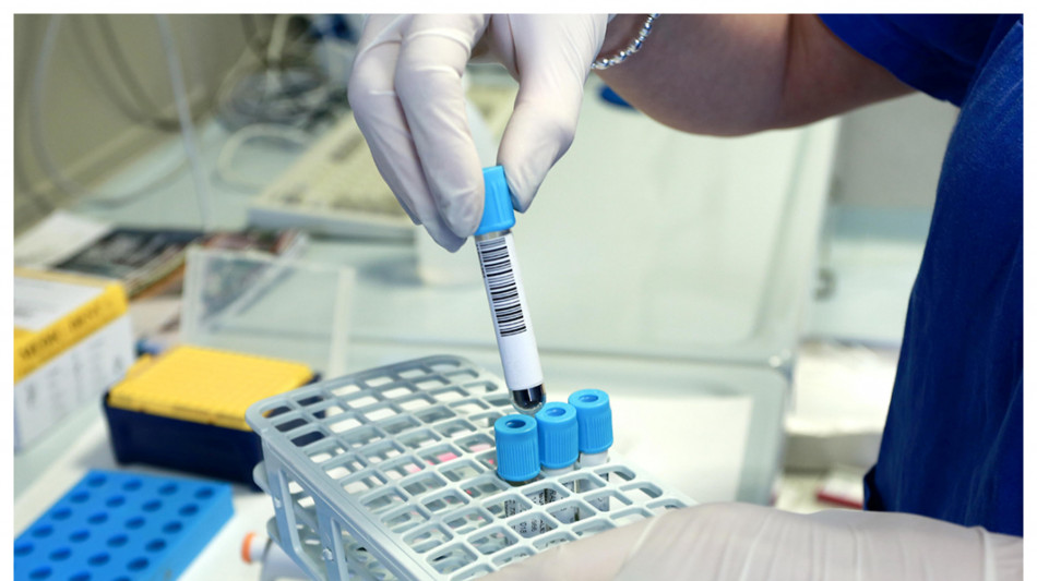 Un test del sangue predice quanto durer&agrave; l'effetto di un vaccino