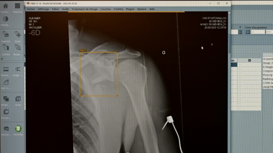 T&Uuml;V-Verband: Weniger R&ouml;ntgenger&auml;te mit M&auml;ngeln - Risiken bleiben aber