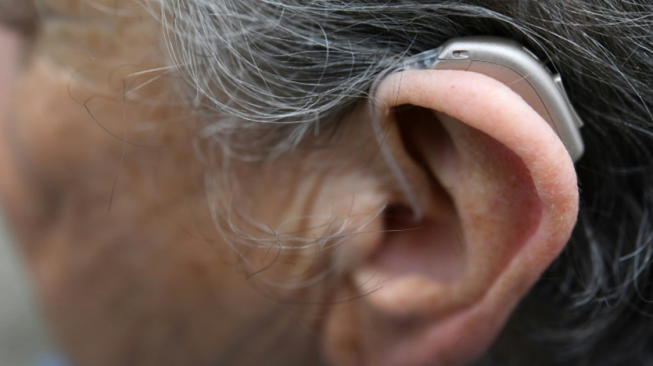 Payback-Punkte bei Kauf von H&ouml;rger&auml;t: BGH pr&uuml;ft Zul&auml;ssigkeit von Werbung