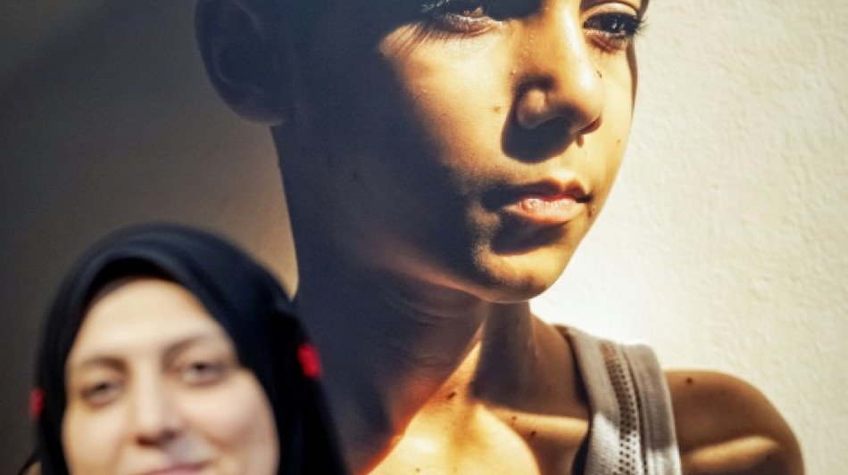 Le portrait d'un enfant palestinien amput&eacute; remporte le World Press Photo