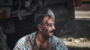 25 killed, 1,000 injured in huge Iran port blast