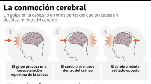 Argentina realiza estudio pionero en Am&eacute;rica Latina sobre lesiones cerebrales del rugby