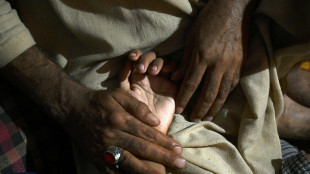 Volver a mover la mano gracias a electrodos, esperanza de los tetrapl&eacute;jicos