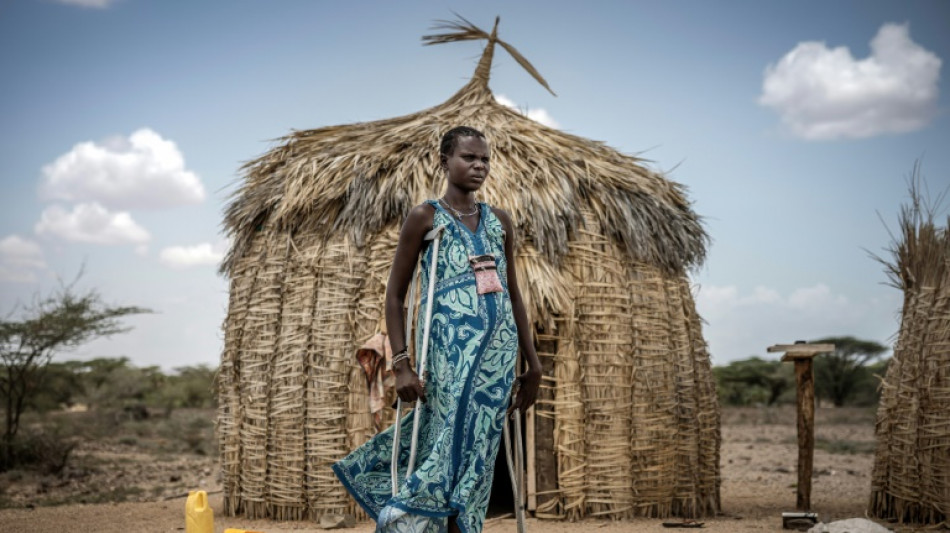 Rare bone-eroding disease ruining lives in Kenya's poorest county