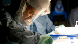 Ruanda inicia ensaio cl&iacute;nico de tratamento contra v&iacute;rus de Marburg