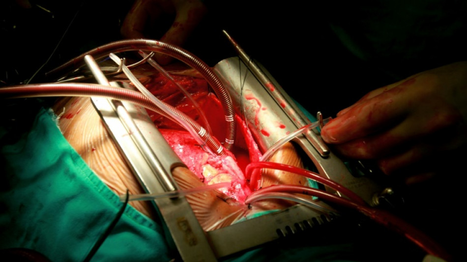 El exceso de ozono en la atm&oacute;sfera aumenta los riesgos cardiacos