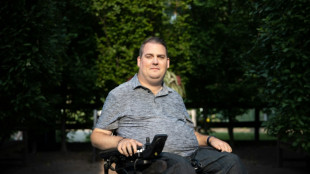 Magia ou rejeição, duas experiências opostas com um implante cerebral