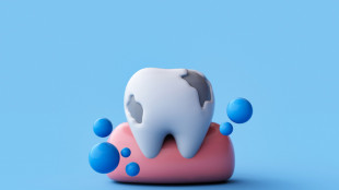 Con carie e malattie gengive rischio ictus quasi raddoppiato