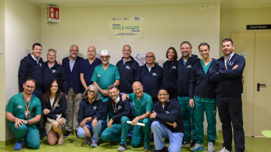 Separate gemelline siamesi attaccate da testa, una è morta