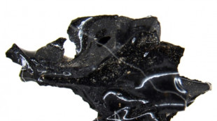 Son cerveau a &eacute;t&eacute; vitrifi&eacute;, probablement dans l'&eacute;ruption du V&eacute;suve