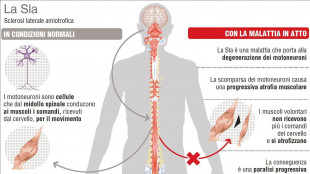 Ricerca sulla Sla, da un recettore la strategia per proteggere i motoneuroni