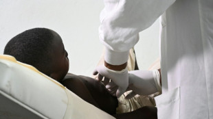 C&ocirc;te d'Ivoire: 28 cas de mpox recens&eacute;s dont un d&eacute;c&egrave;s
