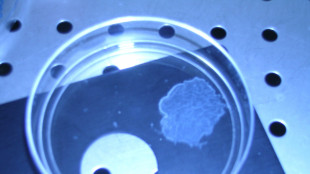 C'è un legame tra rigidità dei tessuti e progressione dei tumori