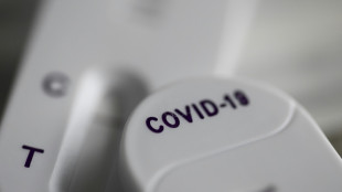 Covid long: une lente am&eacute;lioration des sympt&ocirc;mes au bout de deux ans pour la plupart des patients